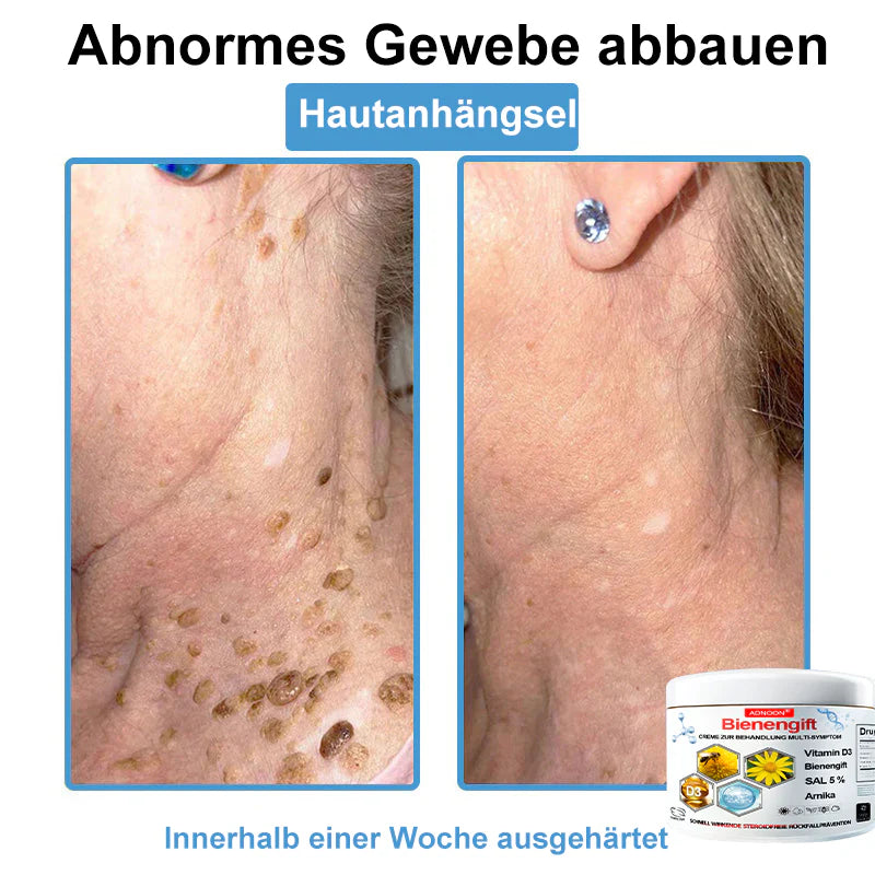 ADNOON® 𝑩𝒊𝒆𝒏𝒆𝒏𝒈𝒊𝒇𝒕 𝑴𝒖𝒍𝒕𝒊𝒔𝒚𝒎𝒑𝒕𝒐𝒎 𝑩𝒆𝒉𝒂𝒏𝒅𝒍𝒖𝒏𝒈𝒔𝒄𝒓𝒆𝒎𝒆 : La solution naturelle et efficace pour traiter une variété de problèmes de peau,