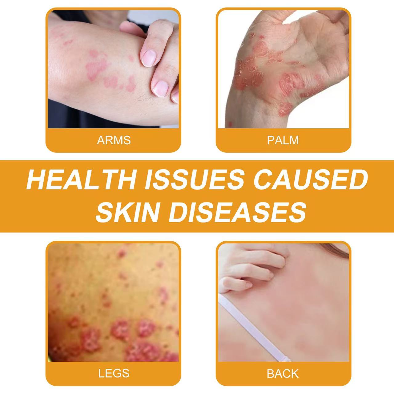 ADNOON® 𝑩𝒊𝒆𝒏𝒆𝒏𝒈𝒊𝒇𝒕 𝑴𝒖𝒍𝒕𝒊𝒔𝒚𝒎𝒑𝒕𝒐𝒎 𝑩𝒆𝒉𝒂𝒏𝒅𝒍𝒖𝒏𝒈𝒔𝒄𝒓𝒆𝒎𝒆 : La solution naturelle et efficace pour traiter une variété de problèmes de peau,