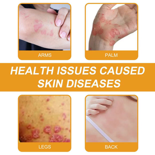 ADNOON® 𝑩𝒊𝒆𝒏𝒆𝒏𝒈𝒊𝒇𝒕 𝑴𝒖𝒍𝒕𝒊𝒔𝒚𝒎𝒑𝒕𝒐𝒎 𝑩𝒆𝒉𝒂𝒏𝒅𝒍𝒖𝒏𝒈𝒔𝒄𝒓𝒆𝒎𝒆 : La solution naturelle et efficace pour traiter une variété de problèmes de peau,