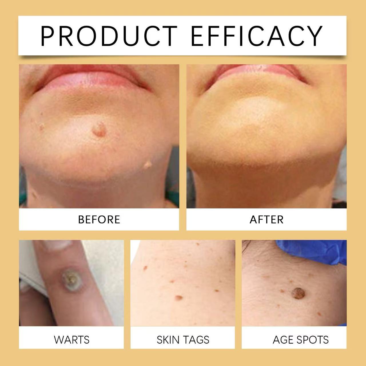 🐝 WiYunBee™ – Crème Réparatrice au Venin d’Abeille