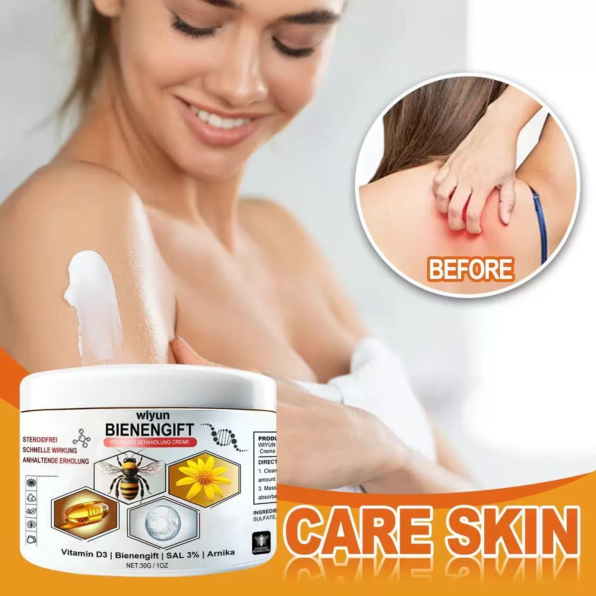 ADNOON® 𝑩𝒊𝒆𝒏𝒆𝒏𝒈𝒊𝒇𝒕 𝑴𝒖𝒍𝒕𝒊𝒔𝒚𝒎𝒑𝒕𝒐𝒎 𝑩𝒆𝒉𝒂𝒏𝒅𝒍𝒖𝒏𝒈𝒔𝒄𝒓𝒆𝒎𝒆 : La solution naturelle et efficace pour traiter une variété de problèmes de peau,