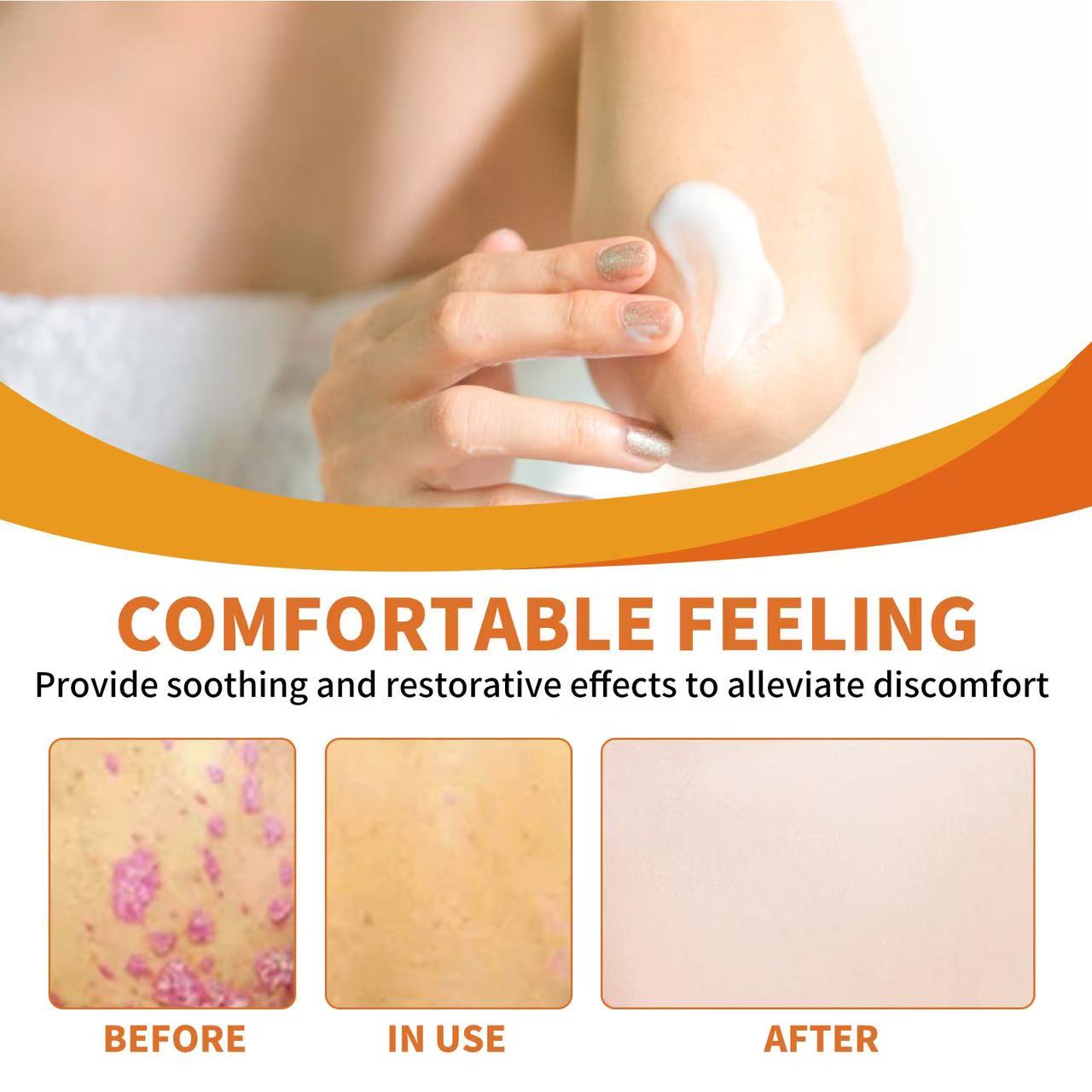 ADNOON® 𝑩𝒊𝒆𝒏𝒆𝒏𝒈𝒊𝒇𝒕 𝑴𝒖𝒍𝒕𝒊𝒔𝒚𝒎𝒑𝒕𝒐𝒎 𝑩𝒆𝒉𝒂𝒏𝒅𝒍𝒖𝒏𝒈𝒔𝒄𝒓𝒆𝒎𝒆 : La solution naturelle et efficace pour traiter une variété de problèmes de peau,