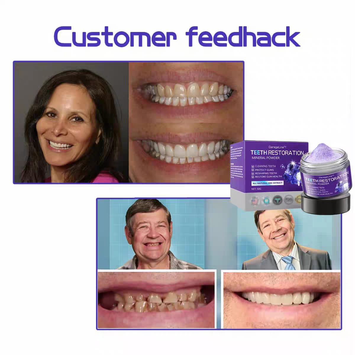Teeth Restoration